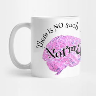 Normal Mug